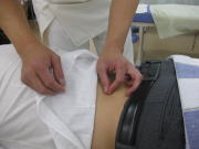 鍼を射す場所の確認をします。