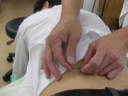 一本ずつ鍼をさします。